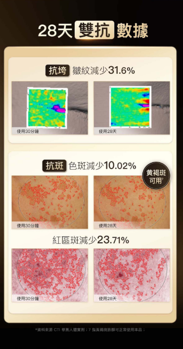 NowMi Nirage 光瑪吉美容儀 DPL冰窄光手具配件【SM812】