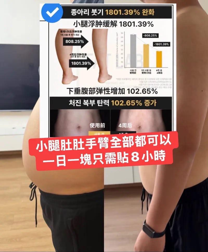 FAT LAB 鳳梨蛋白酶微循環貼片 (一盒8片)【SE1356】
