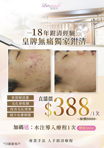 皇牌無痛獨家鉗清【SM2323】